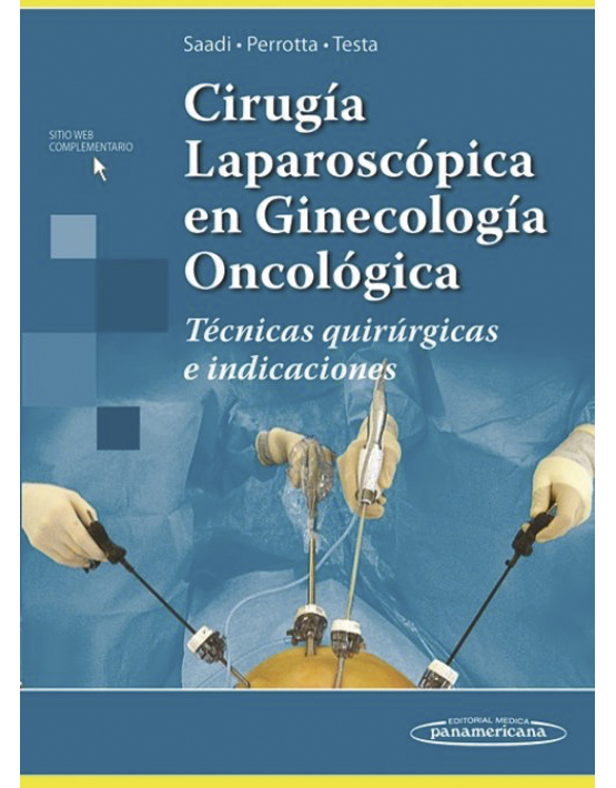 Cirugía Laparoscópica en Ginecología Oncológica 