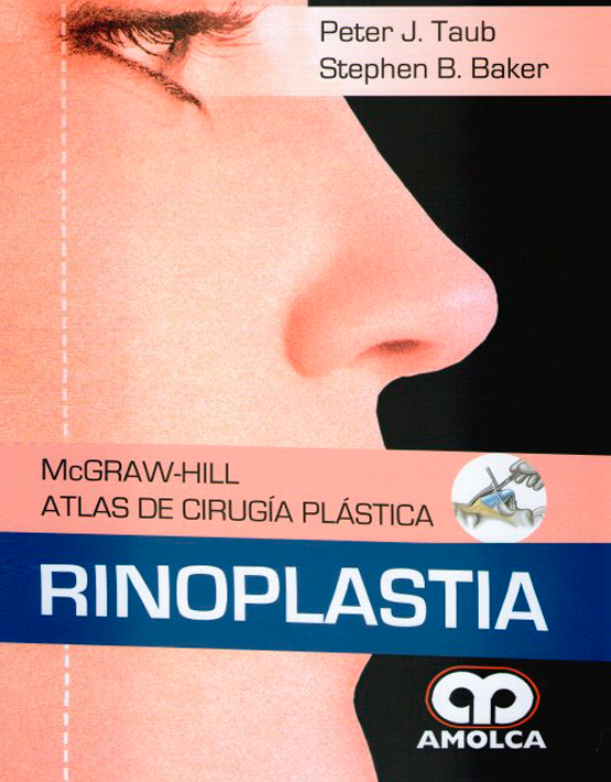 Atlas de Cirugía Plástica - Rinoplastia