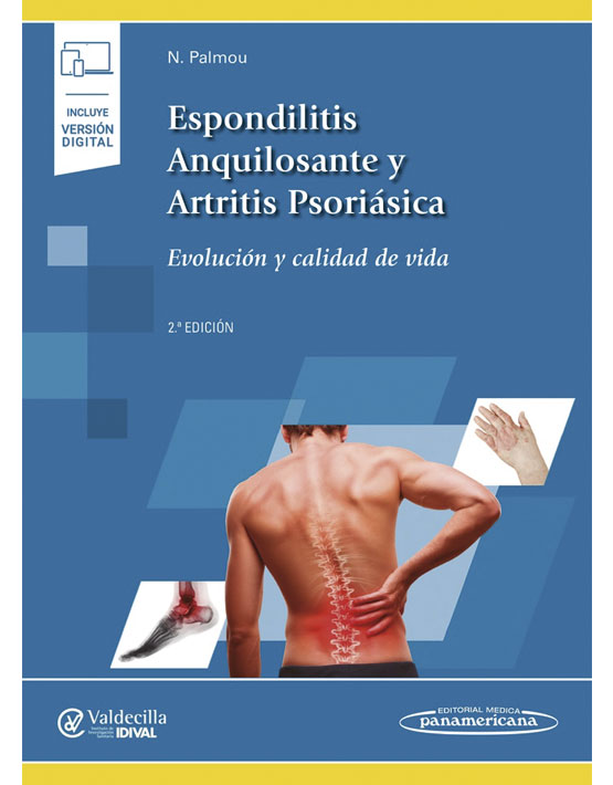 Espondilitis Anquilosante y Artritis Psoriásica (incluye versión digital)