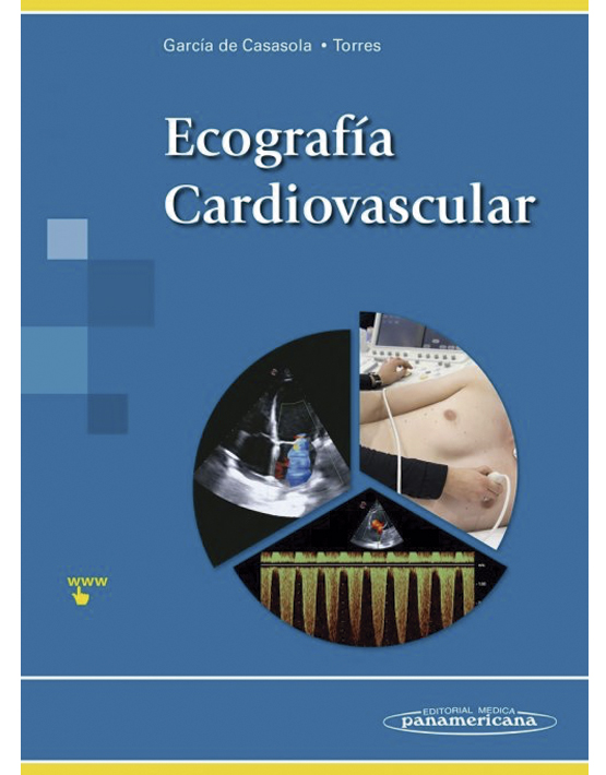 Ecografía Cardiovascular 