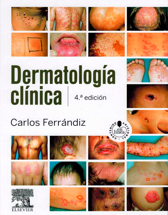  Dermatología clínica