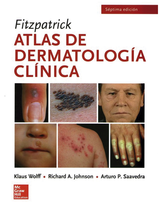 Fitzpatrick Atlas de dermatología clínica