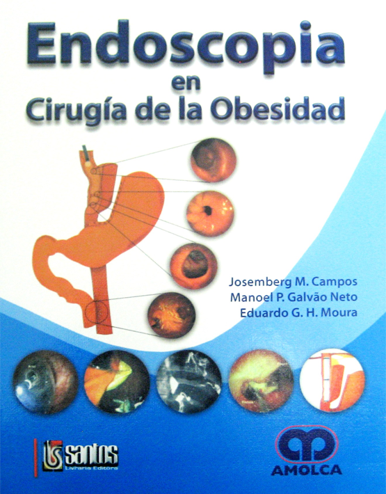 Endoscopia en cirugía de la obesidad 