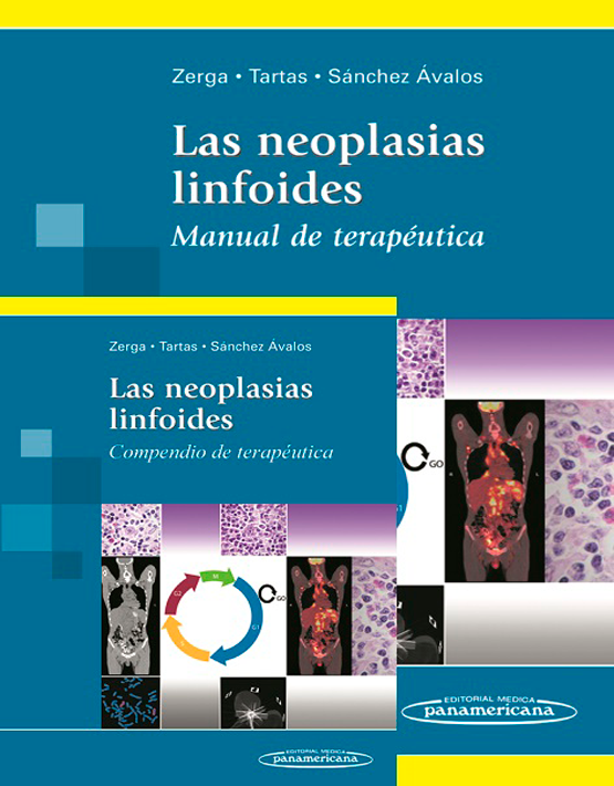 Las neoplasias linfoides. Compendio de terapéutica