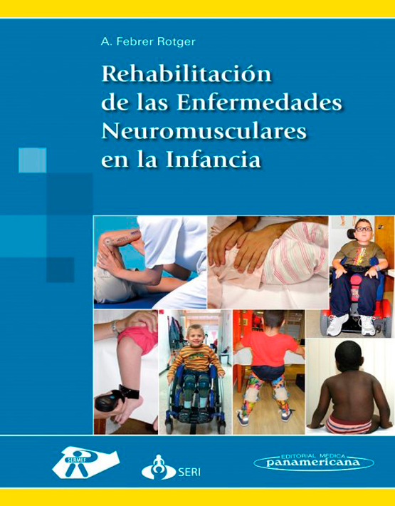  Rehabilitación de las enfermedades neuromusculares en la infancia