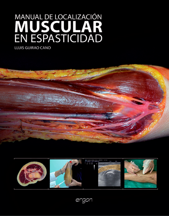 Manual de localización muscular en espasticidad