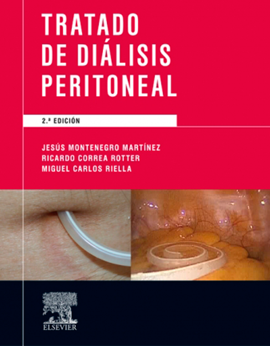 Tratado de diálisis peritoneal