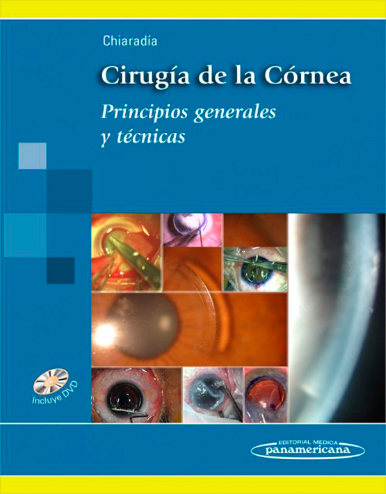 Cirugía de la córnea. Principios generales y técnicas