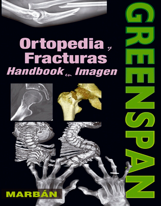 Greenspan Ortopedia y fracturas Handbook en imagen