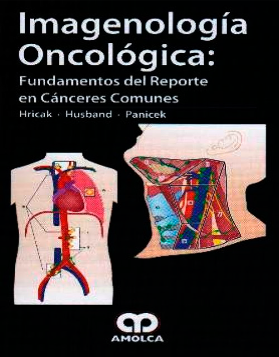 Imagenologia oncológica: Fundamentos del reporte en canceres comunes 