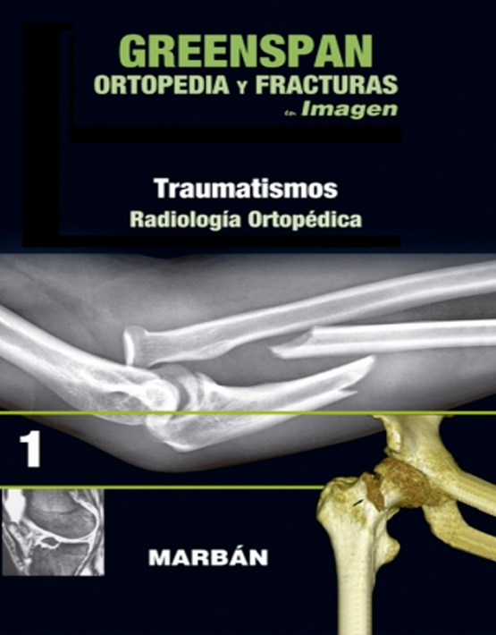Greenspan Ortopedia y Fracturas en imagen Vol. 1