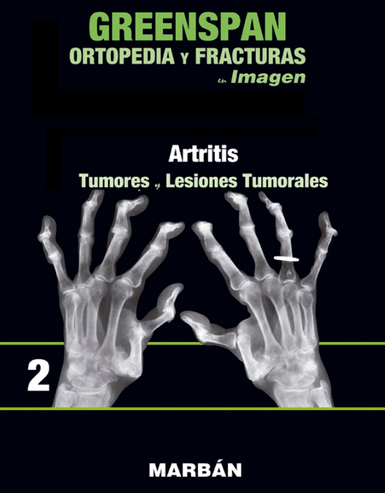 Greenspan Ortopedia y fracturas en imagen Vol. 2