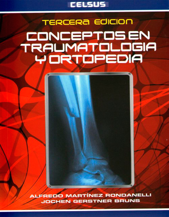 Conceptos en Traumatología y Ortopedia
