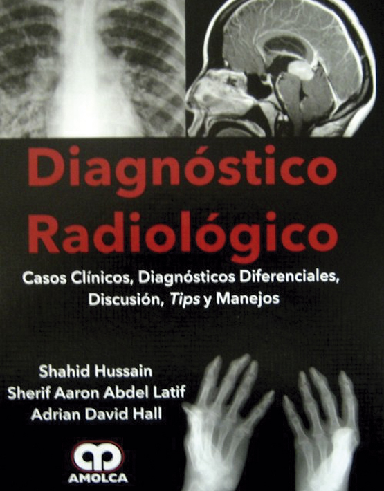 Diagnostico radiológico. Casos clínico, diagnostico diferenciales, discusión, tips y manejos