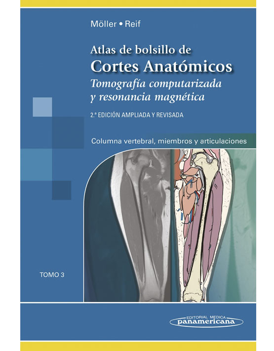 Atlas de Bolsillo de Cortes Anatómicos Tomo 3