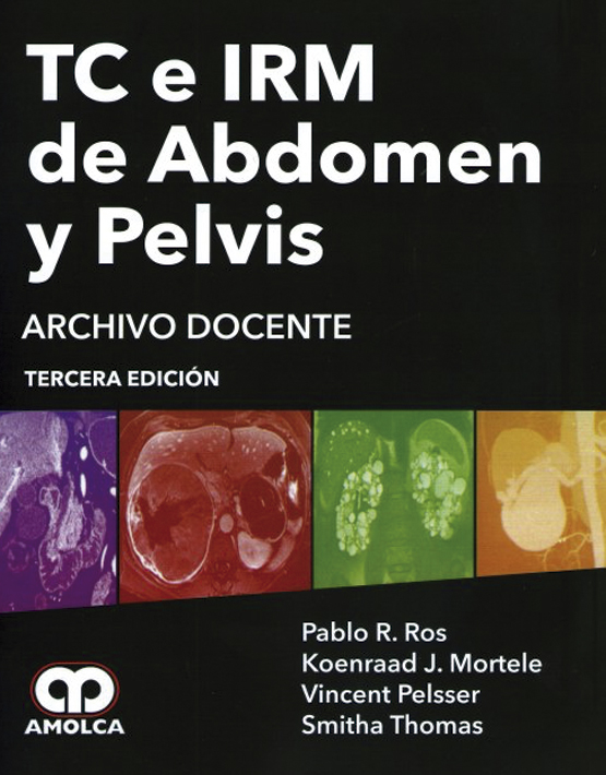 TC e IRM de Abdomen y Pelvis