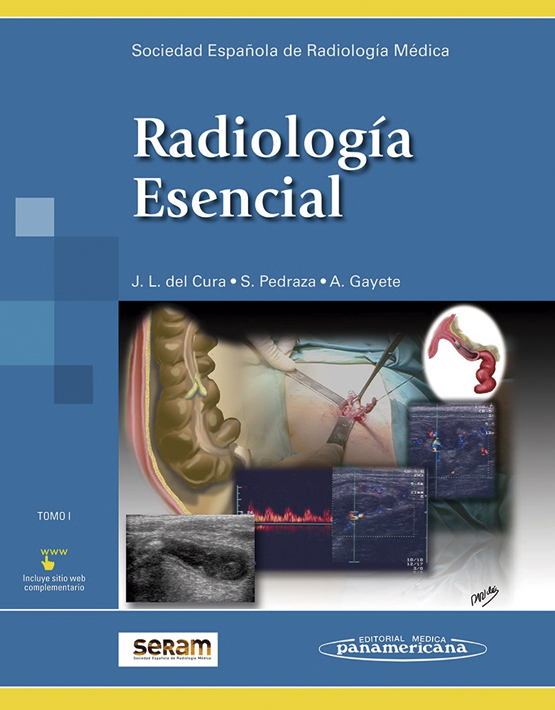 Radiologí­a Esencial - 2 tomos (incluye versión digital)