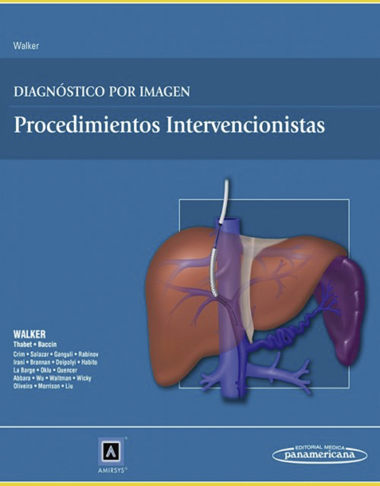 Diagnóstico por Imagen: Procedimientos intervencionistas