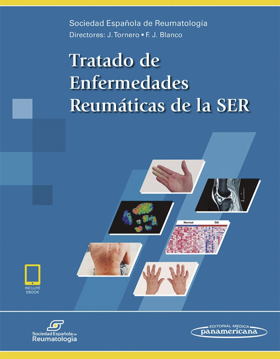 Tratado de Enfermedades Reumáticas de la SER (incluye versión digital)